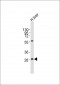 PPAP2A Antibody (C-term)
